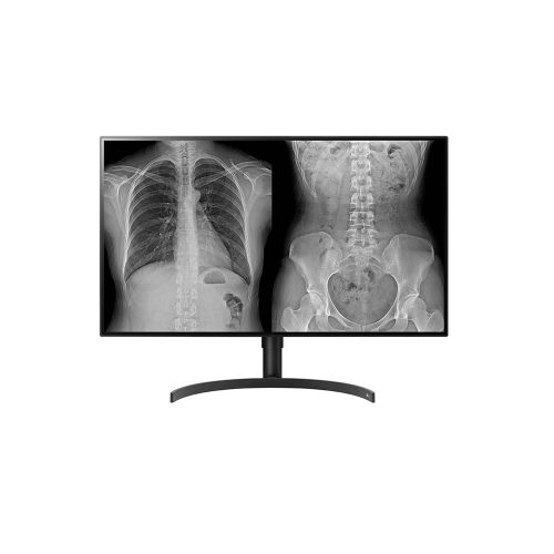 LG 32HL512D-B UHD 8MP-es diagnosztikai monitor